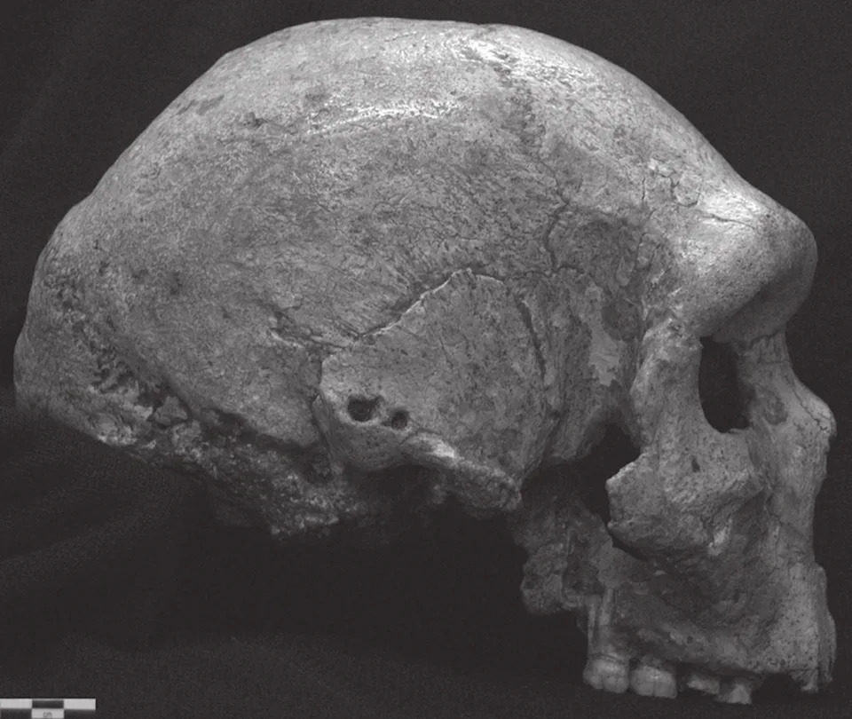 A black-and-white photo of the left side of a skull, known as the 