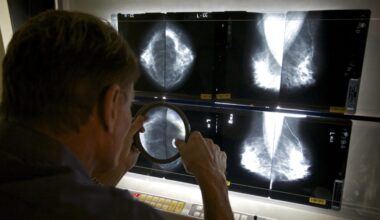 New breast cancer screening trial may answer key AI question