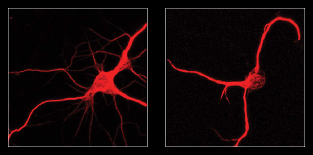 Cultured neurons