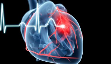 Cardiology Heart Attack Illustration