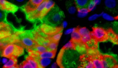 Injured Cells Can 'Vomit' Waste to Boost Healing, Study Finds : ScienceAlert