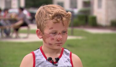 Boy injured in hit-and-run begins recovery – NBC 5 Dallas-Fort Worth