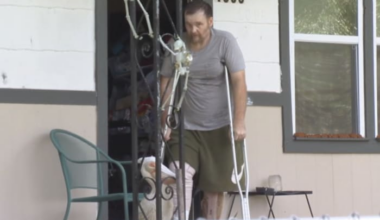 Local man with flesh-eating bacteria claims he was discharged because he is uninsured. Here’s what the hospital said