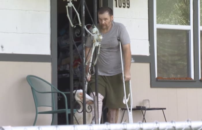 Local man with flesh-eating bacteria claims he was discharged because he is uninsured. Here’s what the hospital said