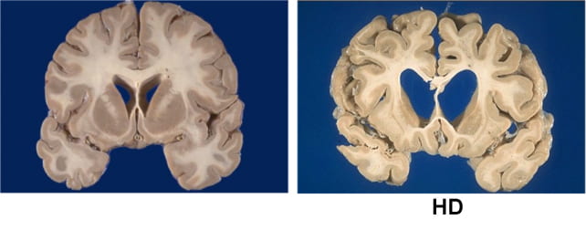 HD brains