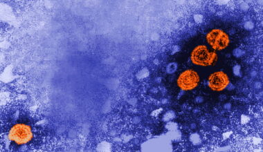 Vaccine critics overlook why newborn hepatitis B shots are routine