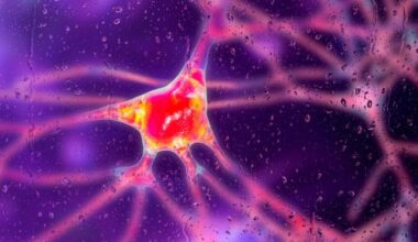 Breakthrough Gene Therapy Slows Huntington's Disease by 75% : ScienceAlert