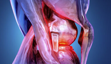 Signs of Rheumatoid Arthritis Uncovered Years Before Symptoms Appear : ScienceAlert