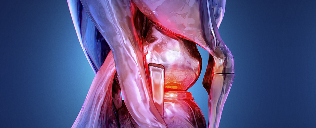 Signs of Rheumatoid Arthritis Uncovered Years Before Symptoms Appear : ScienceAlert