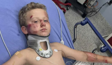 “He was covered in blood,” mom says.