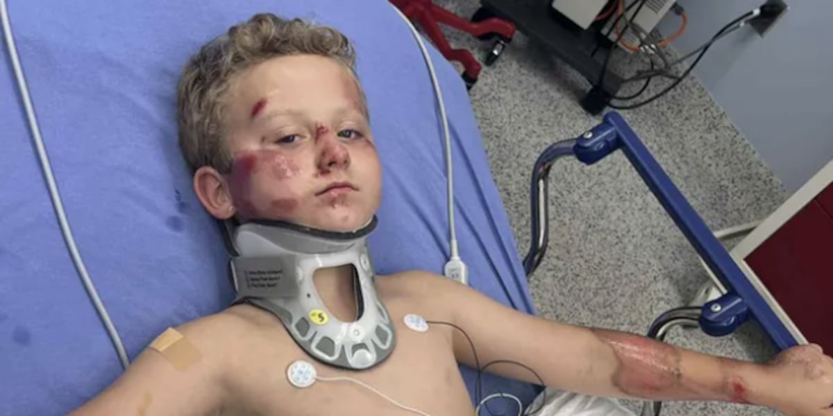 “He was covered in blood,” mom says.