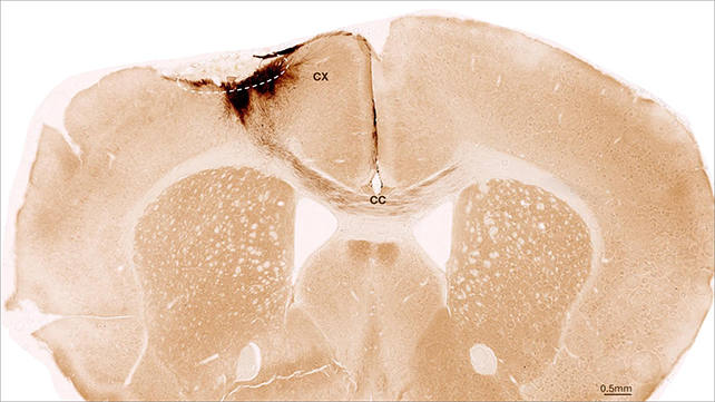 Mouse brain cross section.