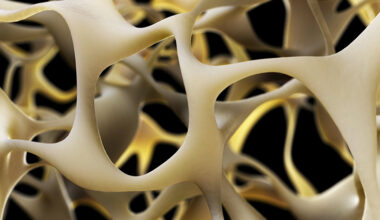 New Breakthrough to Strengthen Bones Could Reverse Osteoporosis : ScienceAlert