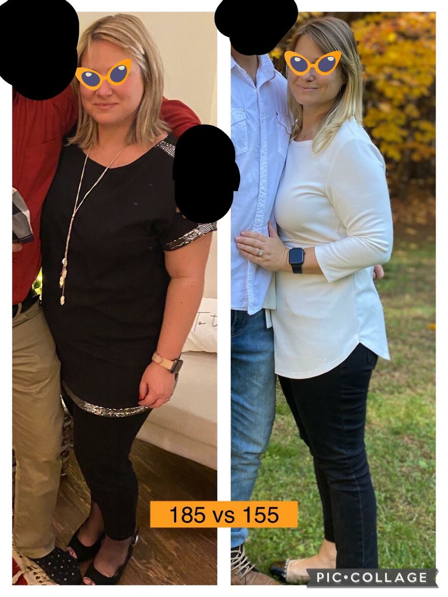 Before and after weight loss comparison image related to Ozempic lawsuit vision loss allegations.