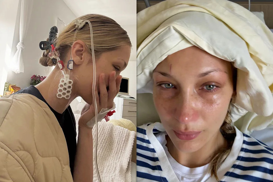 Bella Hadid, left and right, while hospitalized.