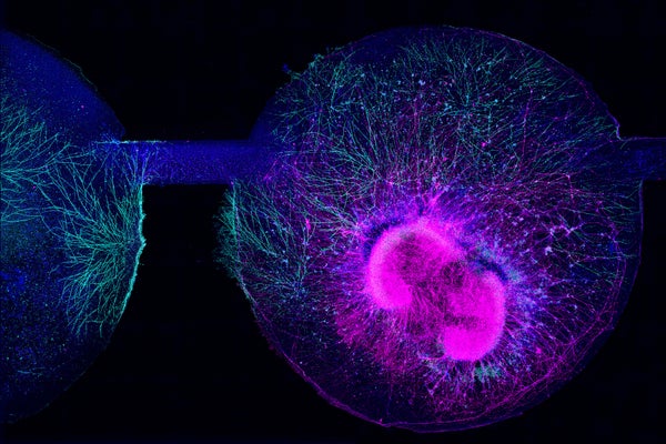 Synapse in 3D brain organoid on microfluidic chip