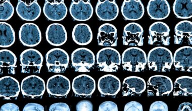 Scientists Might Be Looking for Consciousness in the Wrong Part of the Brain