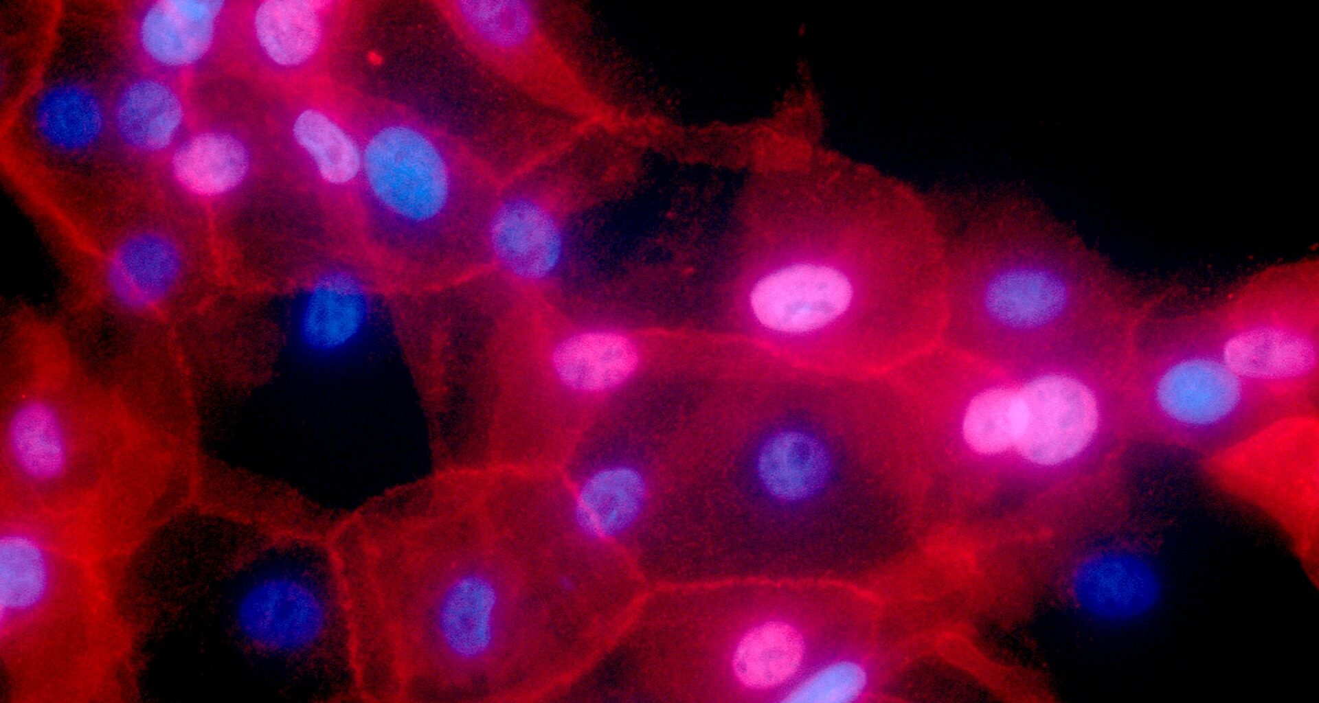 Penn Medicine therapy may prevent breast cancer recurrence