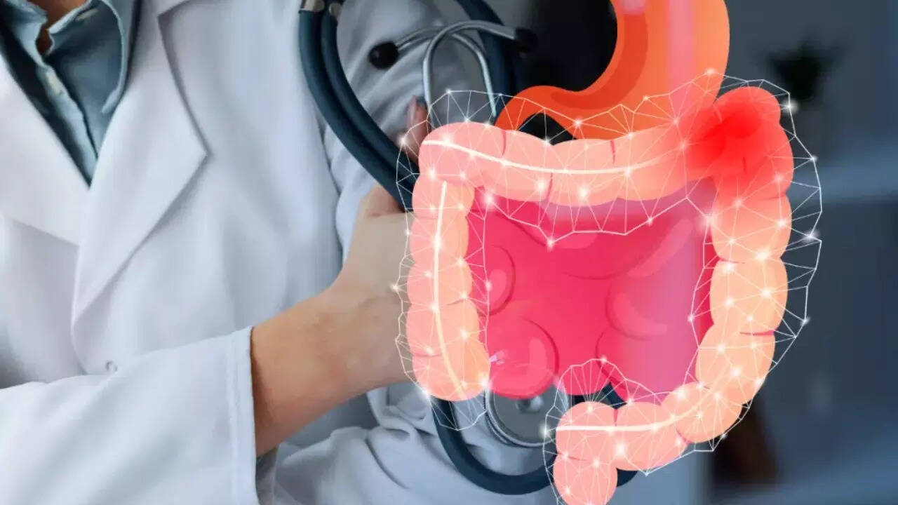Colon cancer (22)