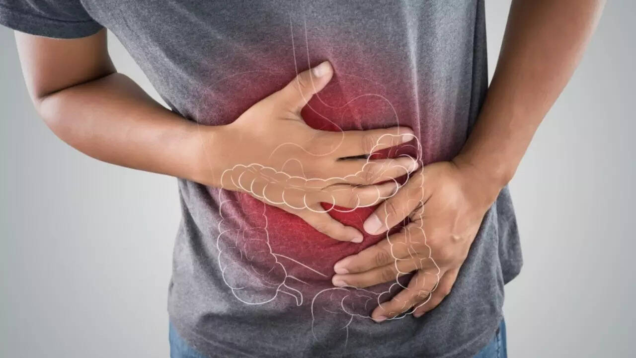 Colon cancer (23)