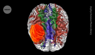 Brain tumours in mice grow more slowly when starved of key amino acid