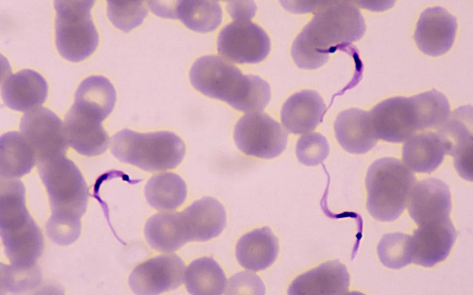 Trypanosoma cruzi