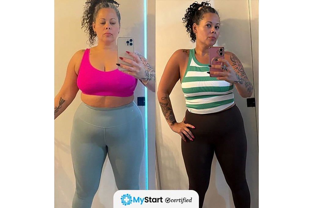MyStart before and after photo