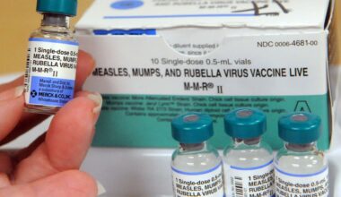 Young child dies from measles-related complications in LA County