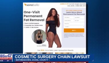 Jacksonville attorney details two pending lawsuits against cosmetic surgery chain Sono Bello – Action News Jax