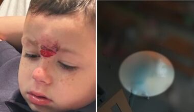 Kindergartener pushed to the ground by older student – NBC10 Philadelphia