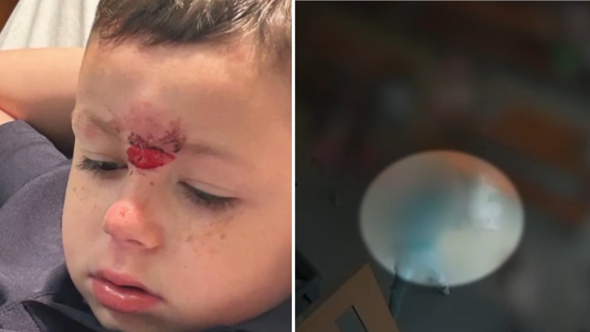 Kindergartener pushed to the ground by older student – NBC10 Philadelphia