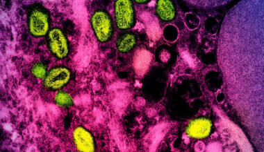 Feds Suspiciously Revive the Name 'Monkeypox' After Dropping It in 2022