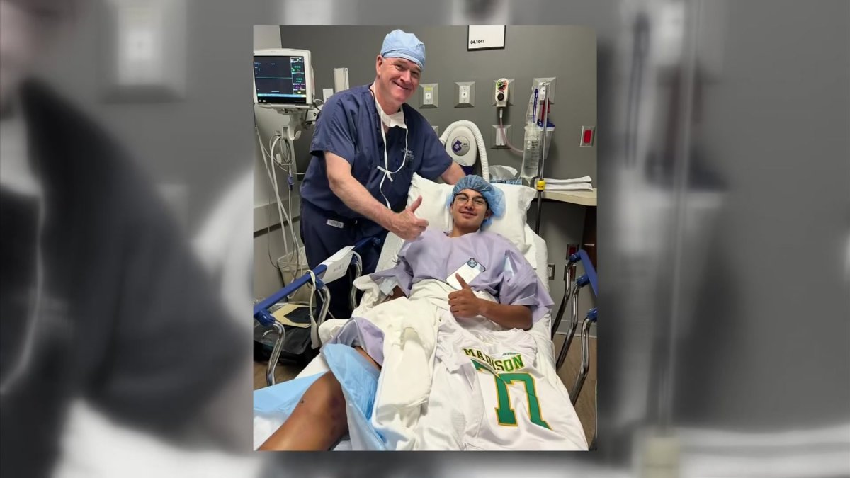 James Madison kicker returns year after tearing major ligaments – NBC 5 Dallas-Fort Worth