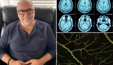 Australian man Patrick Dare's HR meeting reveals frontal lobe dementia diagnosis
