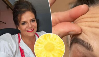 Nutritionist reveals foods that combat wrinkles, bloating, brain fog