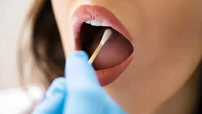 Pancreatic Cancer: Oral microbes linked to increased risk of the deadly disease; risk factors and prevention tips