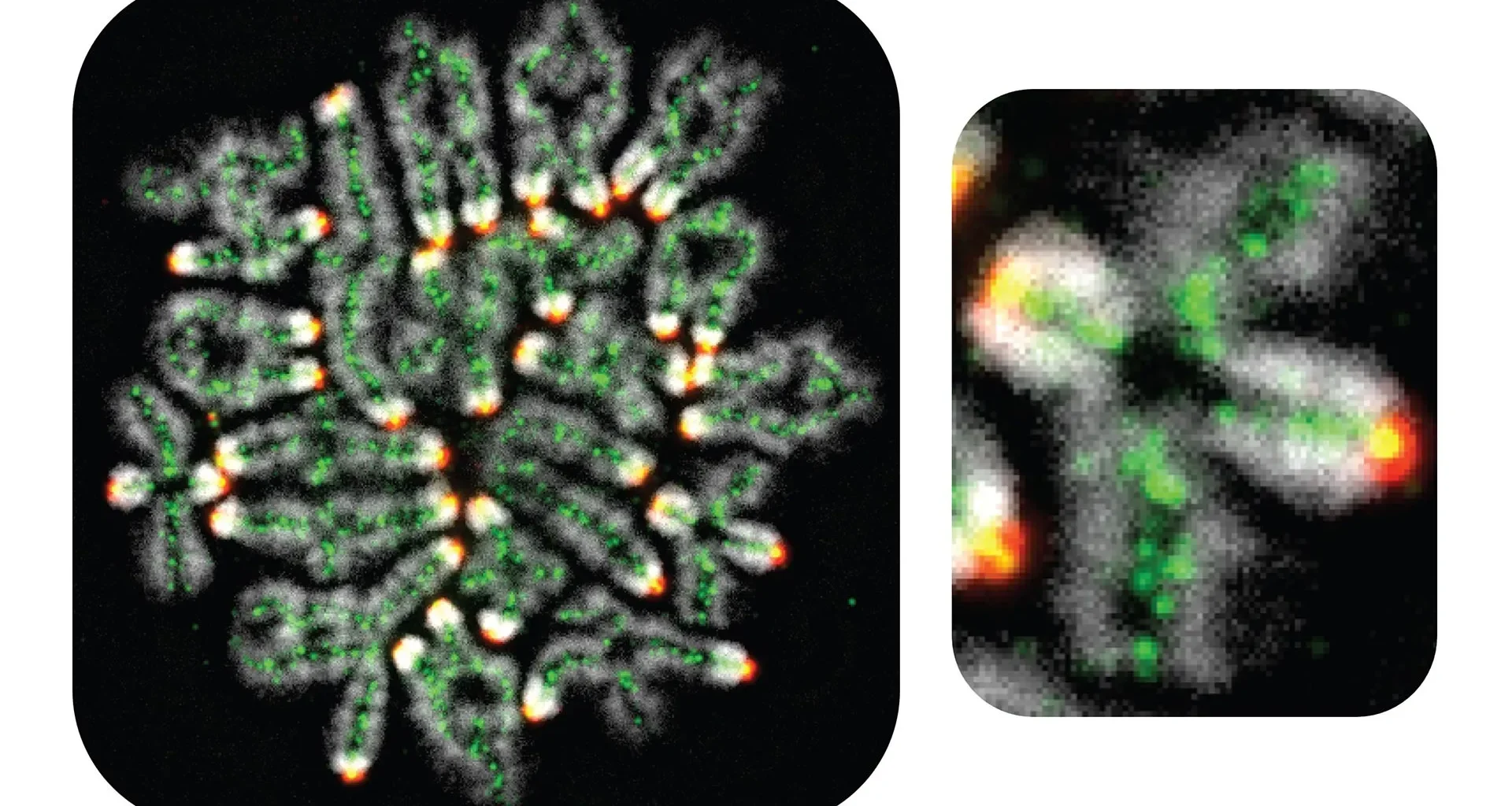 Miscarriages, down syndrome, and infertility all linked to this hidden DNA process