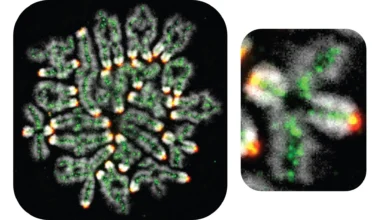 Miscarriages, down syndrome, and infertility all linked to this hidden DNA process