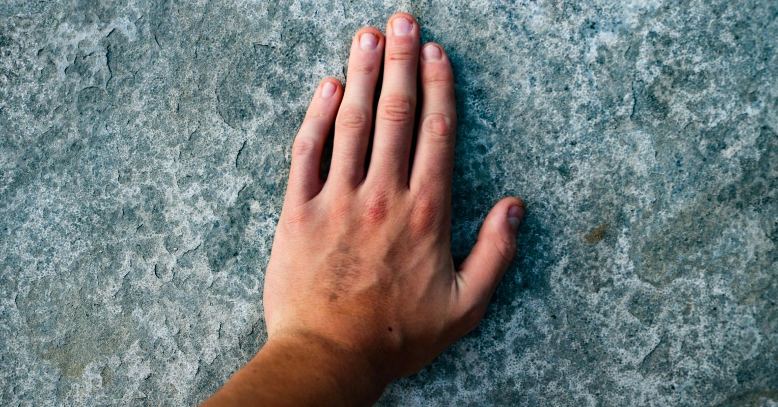 The Liability-Threshold Polygenic Model of Left-Handedness