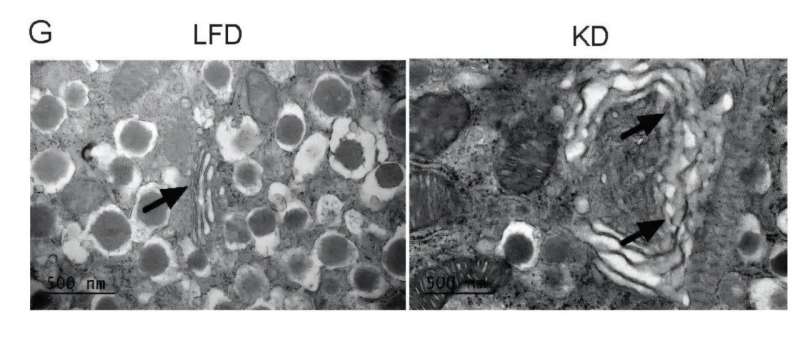 Electron micrograph images of pancreatic β cells showing Golgi dilation in KD. Credit: Molly R. Gallop Popular keto diet linked to glucose intolerance and fatty liver in mice
