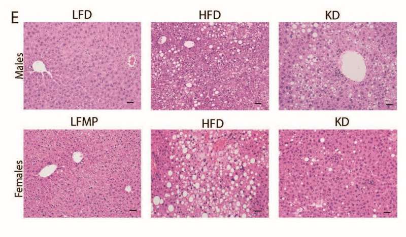 Representative images from males (top) and females (bottom) on diet for 28 and 33 weeks, respectively. Scale bars, 20 μm. Credit: Molly R. Gallop Popular keto diet linked to glucose intolerance and fatty liver in mice