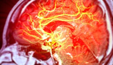 Stem Cells Repair Brain Damage Caused by Stroke in Mice : ScienceAlert