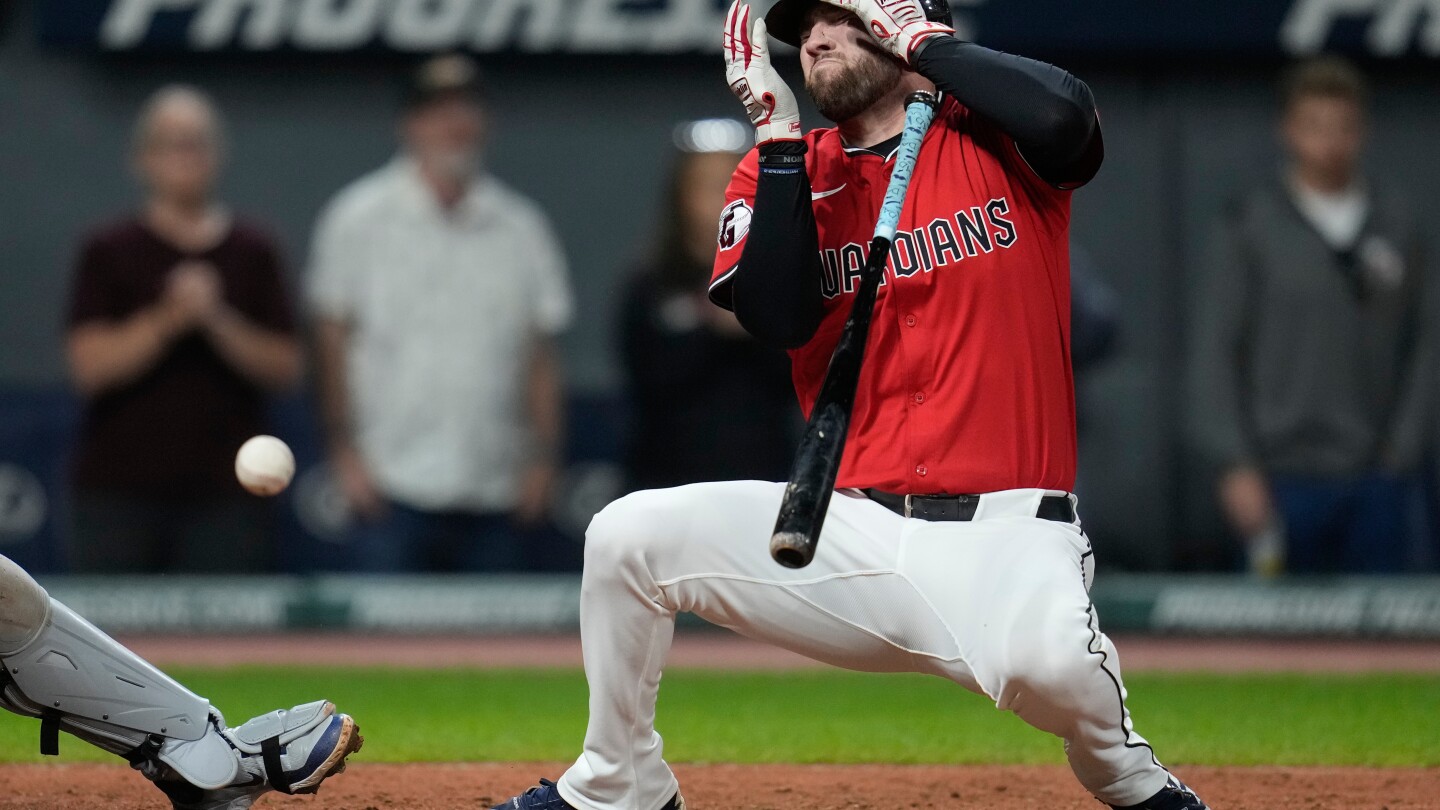 Guardians' David Fry sustains broken nose, facial fractures