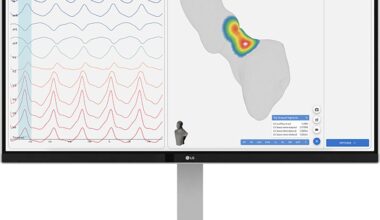 New AFib detection device being tested in Jacksonville