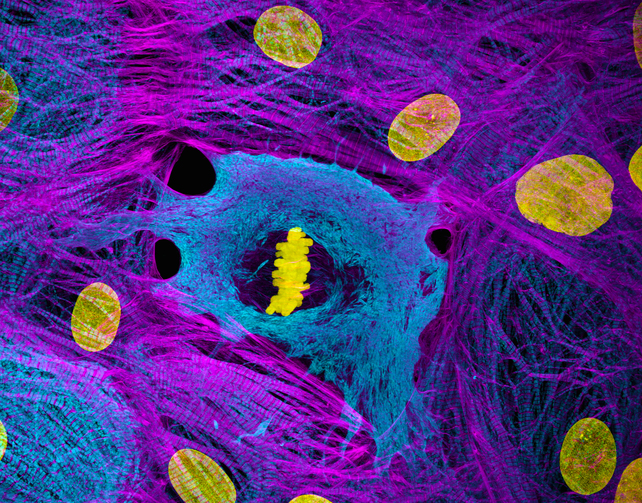 A bundle of chromosomes shown in yellow are positioned at the centre of a rounded cell, stained blue. This cell is surrounded by other cells and organelles, stained in various colours. 