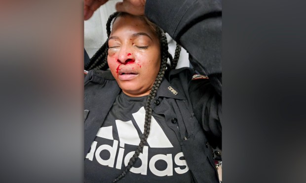 Correction Officer Shamika Mitchell is pictured after being attacked on Rikers Island in February 2025.