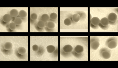 Parsing phenotypes in people with shared autism-linked variants; and more
