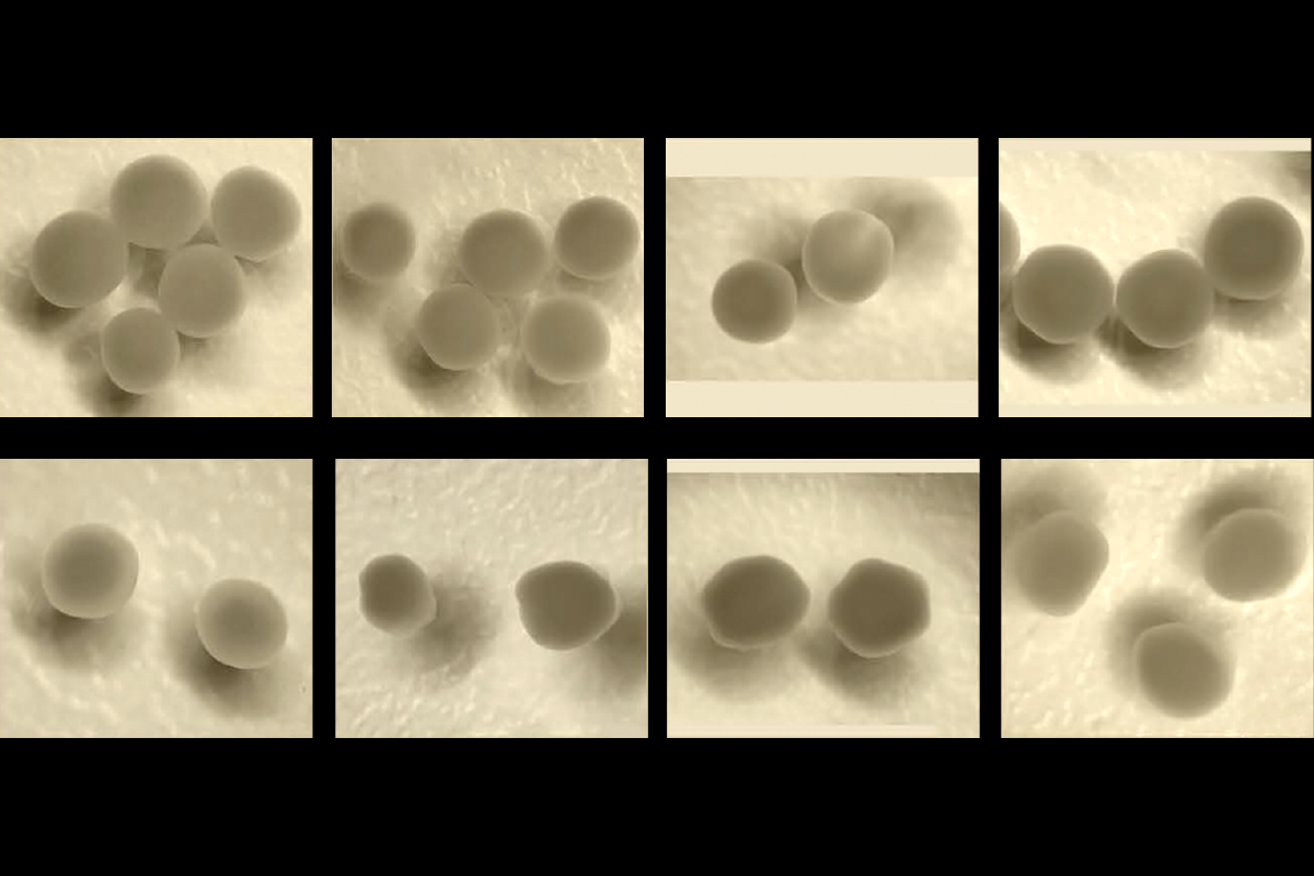 Parsing phenotypes in people with shared autism-linked variants; and more