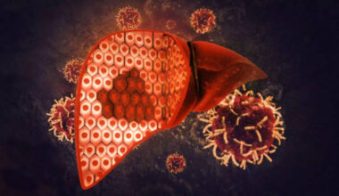 Not lack of appetite, but these are the early symptoms of this disease