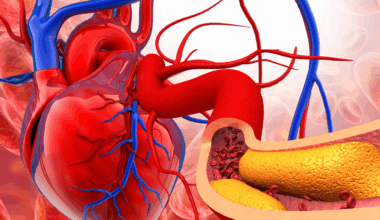 Cardiologist recommends adding 5 foods to our diet to reduce heart blockages and repair blood vessels